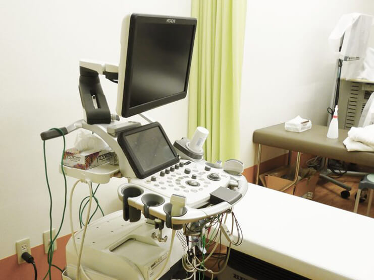 超音波診断装置