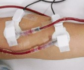 漏血センサーシール